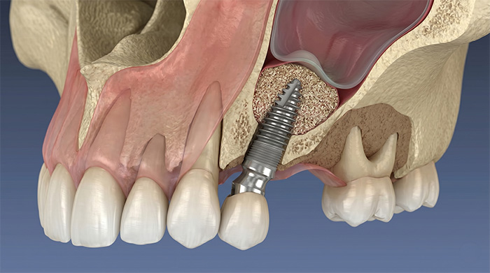 難症例にも対応可能な技術